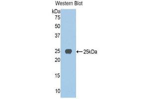 Western Blotting (WB) image for anti-Jagged 1 (JAG1) (AA 836-1047) antibody (ABIN1859518) (JAG1 antibody  (AA 836-1047))