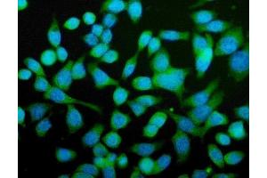 IF analysis of CPN1 using anti-CPN1 antibody (ABIN7600158). (CPN1 antibody  (AA 158-208))