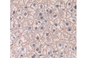 Figure. (Patched 1 antibody  (AA 227-436))