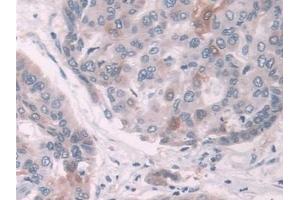 Immunohistochemistry (IHC) image for anti-NAD(P)H Dehydrogenase, Quinone 1 (NQO1) (AA 2-274) antibody (ABIN7430126)