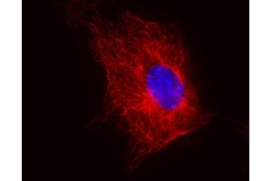 Immunocytochemistry (ICC) image for anti-Tubulin, beta (TUBB) antibody (ABIN93914)
