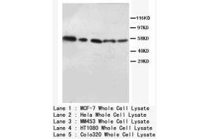 Image no. 2 for anti-V-Akt Murine Thymoma Viral Oncogene Homolog 1/2 (AKT1/2) (N-Term) antibody (ABIN1494209) (AKT1/2 antibody  (N-Term))