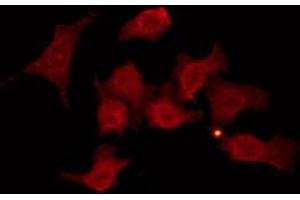 ABIN6274257 staining Hela by IF/ICC. (GRK6 antibody  (N-Term))