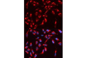 Immunofluorescence analysis of U2OS cell using WASL antibody. (Neural Wiskott-Aldrich syndrome protein (WASL) (AA 1-250) antibody)