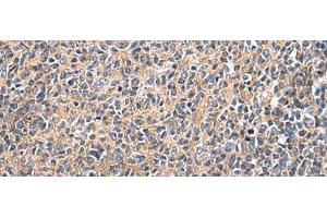 Immunohistochemistry of paraffin-embedded Human tonsil tissue using UBTD1 Polyclonal Antibody at dilution of 1:25(x200) (UBTD1 antibody)
