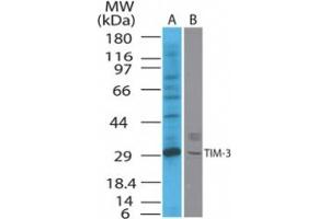 Image no. 1 for anti-Hepatitis A Virus Cellular Receptor 2 (TIM 3) (AA 100-200) antibody (ABIN208461)