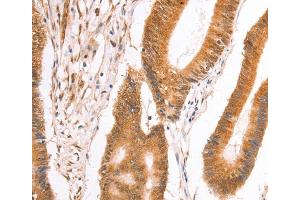Immunohistochemistry (IHC) image for anti-Tax1 (Human T-Cell Leukemia Virus Type I) Binding Protein 1 (TAX1BP1) antibody (ABIN2428864) (TAX1BP1 antibody)