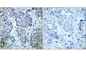 Immunohistochemistry (IHC) image for anti-Mitogen-Activated Protein Kinase Kinase 4 (MAP2K4) (AA 227-276), (pThr261) antibody (ABIN1531968)