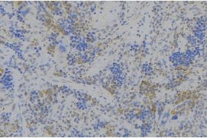 ABIN6279701 at 1/100 staining Human lymph node tissue by IHC-P.