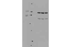 Western blot analysis of Mouse kidney tissue lysates showing detection of ENaC protein using Rabbit Anti-ENaC Polyclonal Antibody . (SCNN1A antibody  (AA 46-68) (Atto 390))