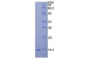 SDS-PAGE analysis of Mouse beta 2-Microglobulin Protein. (beta-2 Microglobulin Protein)