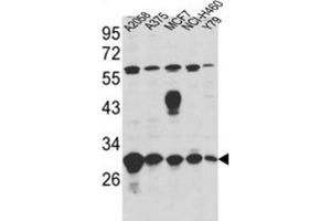 Western Blotting (WB) image for anti-Endoplasmic Reticulum Protein 29 (ERP29) antibody (ABIN3001703) (ERP29 antibody)