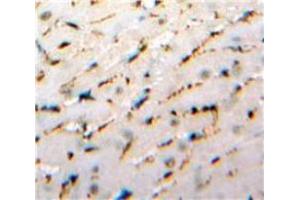 Used in DAB staining on fromalin fixed paraffin-embedded Heart tissue (IL-33 antibody  (AA 112-270))