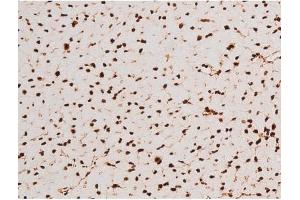 Immunohistochemistry (IHC) image for anti-REL proto-oncogene (c-Rel) (pSer503) antibody (ABIN6255382)