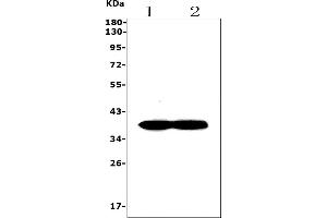 Western blot analysis of SYP using anti-SYP antibody (ABIN7603120).