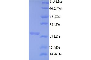Vacuolar Protein Sorting 13 Homolog B (Yeast) (VPS13B) (AA 4-200), (partial) protein (His tag)