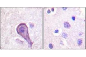 Immunohistochemistry analysis of paraffin-embedded human brain tissue, using Rhodopsin (Ab-334) Antibody. (Rhodopsin antibody  (AA 299-348))