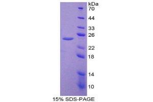 SDS-PAGE (SDS) image for Interleukin 27 Receptor, alpha (IL27RA) (AA 93-273) protein (His tag) (ABIN2125491)
