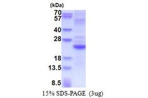 SDS-PAGE (SDS) image for Interleukin 28A (Interferon, lambda 2) (IL28A) (AA 26-200) protein (His tag) (ABIN5853550)