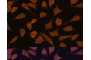 Immunofluorescence analysis of L929 cells using SEPT3 Polyclonal Antibody at dilution of 1:100. (Septin 3 antibody)