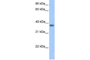 WB Suggested Anti-NEUROD6 Antibody Titration:  0. (NEUROD6 antibody  (Middle Region))