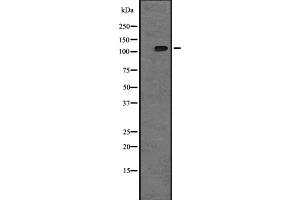 Western blot analysis of TAOK2 expression in A431 whole cell lysate ,The lane on the left is treated with the antigen-specific peptide.