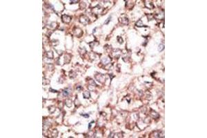 Image no. 3 for anti-Dickkopf 2 Homolog (DKK2) (N-Term) antibody (ABIN357069) (DKK2 antibody  (N-Term))