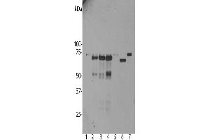 Western blot analysis of untransfected primary mouse neuron and glia cell cultures (lane 1), the same cells transduced with human ubiquilin 2 wild type (lane 2), with ubiquilin 2 P506T mutant (lane 3), with ubiquilin 2 P497S mutant (lane 4) and with enhanced GFP control (lane 5), all probed with ABIN1580461. (Ubiquilin 2 antibody)