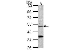 WB Image Sample (30 ug of whole cell lysate) A: Hela 10% SDS PAGE antibody diluted at 1:1000 (Chitotriosidase 1 antibody)