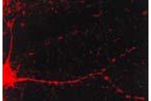 CamKII (6G9) in cultured cortical neurons. (CAMKII gamma antibody)