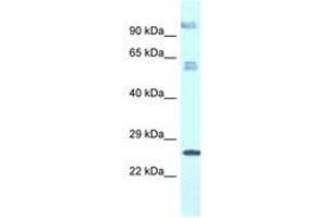 Image no. 1 for anti-Transmembrane Protein 222 (TMEM222) (AA 106-155) antibody (ABIN6747477) (TMEM222 antibody  (AA 106-155))