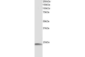 ABIN184852 staining (1µg/ml) of human muscle lysate (RIPA buffer, 30µg total protein per lane). (HSPB8 antibody  (C-Term))