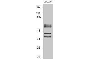 Western Blotting (WB) image for anti-Periphilin 1 (PPHLN1) (Internal Region) antibody (ABIN3186395) (PPHLN1 antibody  (Internal Region))