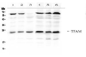 Western blot analysis of mtTFA using anti- mtTFA antibody .