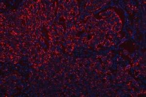 IF analysis of Scavenging Receptor SRB2/SCARB2 using anti-Scavenging Receptor SRB2/SCARB2 antibody (ABIN7601833). (SCARB2 antibody  (AA 48-357))