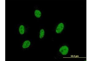 Immunofluorescence of monoclonal antibody to SIX2 on HeLa cell.