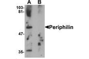 Western blot analysis of Periphilin in mouse colon tissue lysate with Periphilin Antibody   at 1 ug/mL in (A) the absence and (B) the presence of blocking peptide.