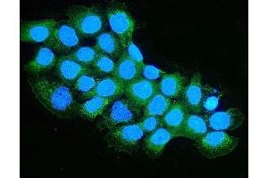 IF analysis of OXCT1/SCOT using anti-OXCT1/SCOT antibody (ABIN7601419). (OXCT1 antibody  (AA 35-309))