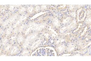 Immunohistochemistry (IHC) image for anti-Annexin A5 (ANXA5) (AA 1-321) antibody (ABIN7431455)