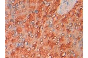 Detection of PGP in Mouse Pancreas Tissue using Polyclonal Antibody to Phosphoglycolate Phosphatase (PGP)