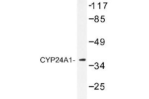 Image no. 1 for anti-Cytochrome P450, Family 24, Subfamily A, Polypeptide 1 (CYP24A1) antibody (ABIN272271)
