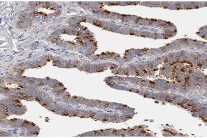 ABIN6266939 at 1/100 staining human Fallopian tube tissue sections by IHC-P. (DLEC1 antibody  (N-Term))