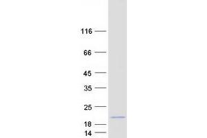 Validation with Western Blot (ACN9 Protein (Myc-DYKDDDDK Tag))