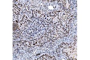IHC analysis of HDAC2 using anti-HDAC2 antibody (ABIN7601564).