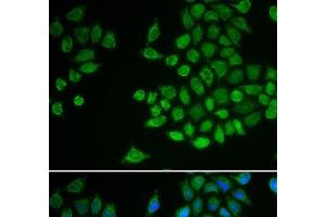 Immunofluorescence analysis of MCF-7 cells using PTPN2 Polyclonal Antibody (PTPN2 antibody)