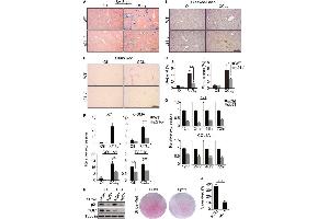 Western Blotting (WB) image for anti-COL1A2/COL1A1 antibody (ABIN5596819)