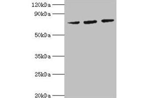 Western blot All lanes: HSPA6 antibody at 2 μg/mL Lane 1: MCF-7 whole cell lysate Lane 2: A431 whole cell lysate Lane 3: Jurkat whole cell lysate Secondary Goat polyclonal to rabbit IgG at 1/10000 dilution Predicted band size: 72 kDa Observed band size: 72 kDa (HSPA6 antibody  (AA 1-637))