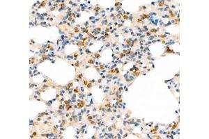 Immunohistochemistry of paraffin embedded rat lung using AMIGO2 (ABIN7072966) at dilution of 1: 1300 (400x lens)