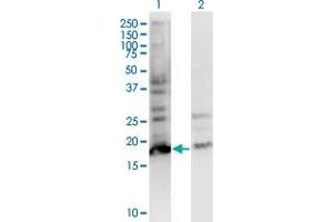 Western Blot analysis of BTF3L4 expression in transfected 293T cell line by BTF3L4 monoclonal antibody (M05), clone 2G10.