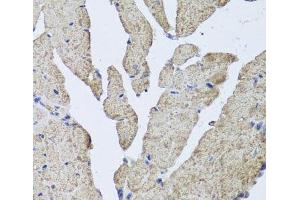 Immunohistochemistry of paraffin-embedded Mouse heart using HBA2 Polyclonal Antibody at dilution of 1:100 (40x lens).